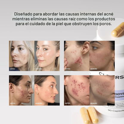 MINDBODYSKIN® CLEARSTEM  | "El Purificador Hormonal"